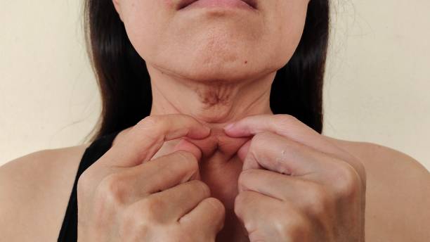 How To Treat Neck Wrinkles? 6 Effective Ways to Treat Them